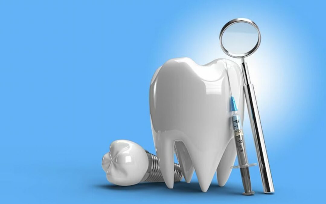 Procedura di impianto dentale: tutto quello che c’è da sapere