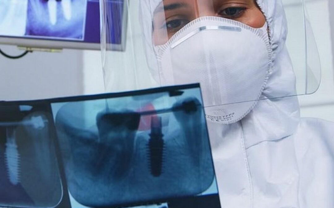 Quante radiazioni contiene una radiografia dentale?