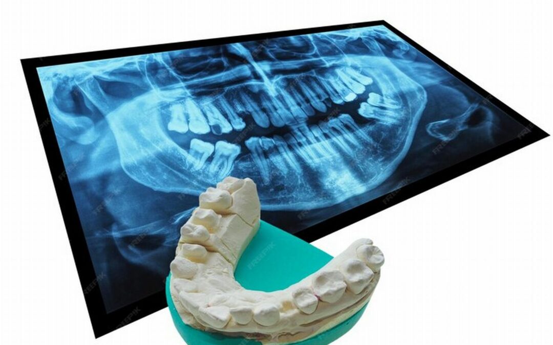 Ortodonzia e disturbi temporo-mandibolari: una panoramica