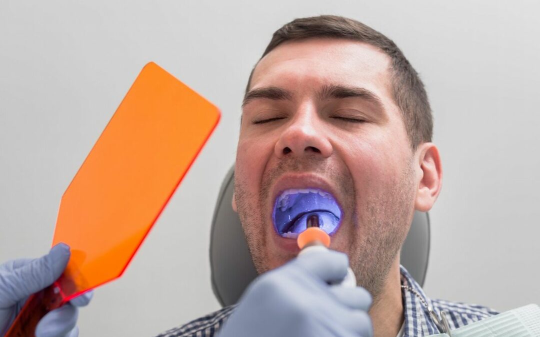 Migliori pratiche per la disinfezione delle impronte dentali